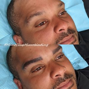 Male pigmentation eyebrows